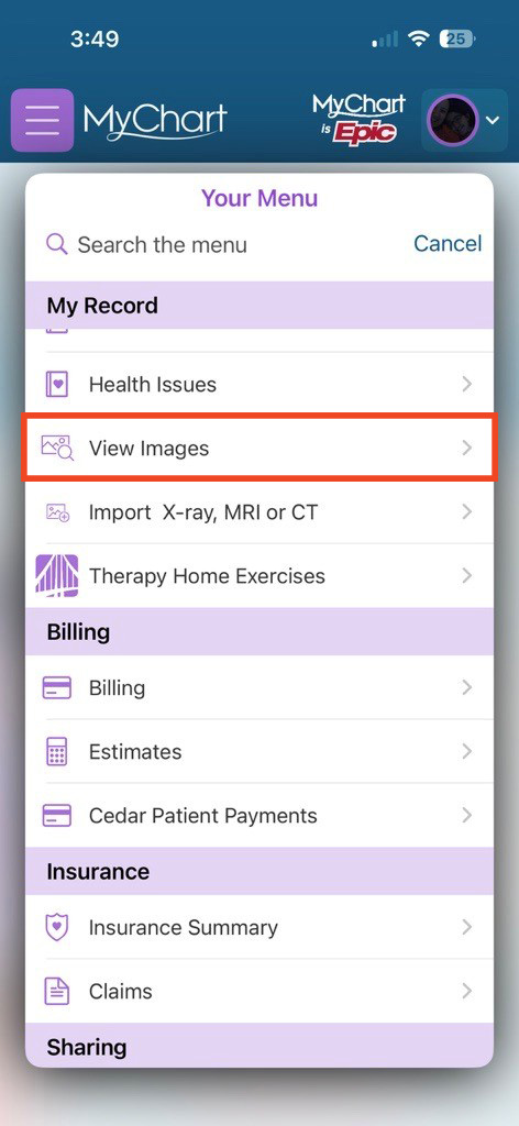 screenshot of MyChart mobile with red box showing where to select